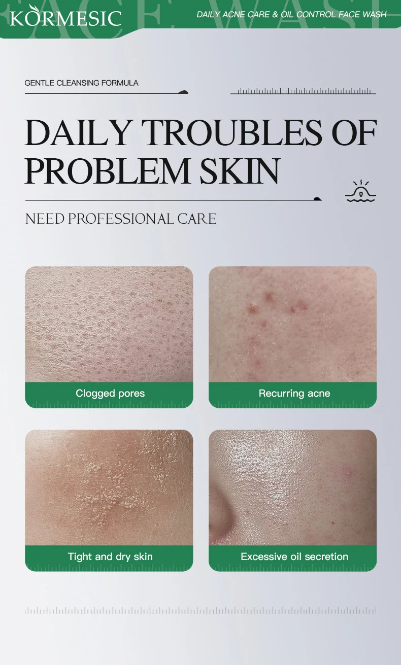 Acne Care & Oil Control Face Wash with Salicylic Acid & Niacinamide 4 acne oil control face wash spu982815736082 desc 4
