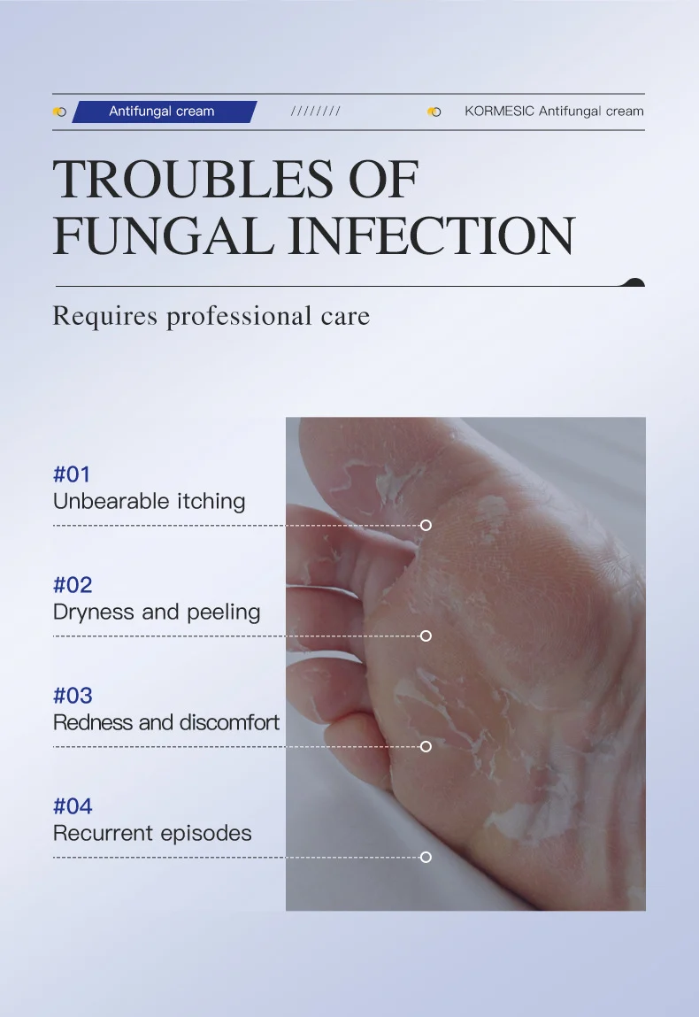 Antifungal Cream - Fast Itch Relief & Skin Repair Formula 2 antifungal foot cream spu1005004144476 desc 2