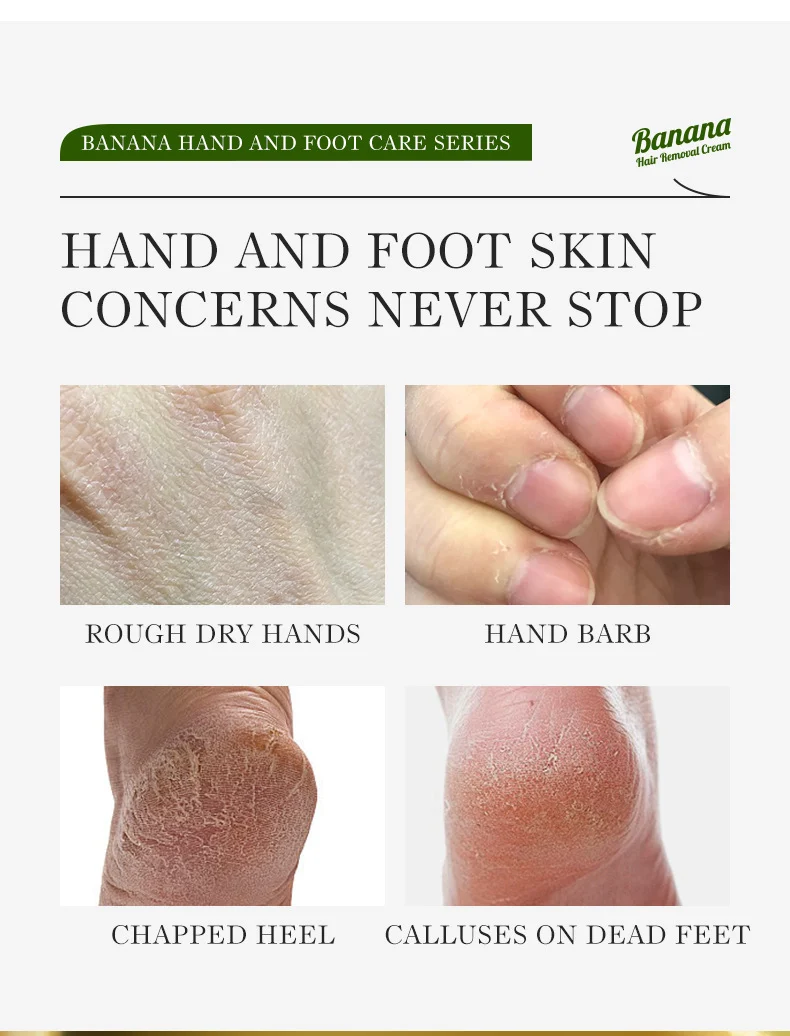 Banana Foot Care Set - Comprehensive Kit for Dry Skin 3 banana foot hand care set spu807169362020 desc 3