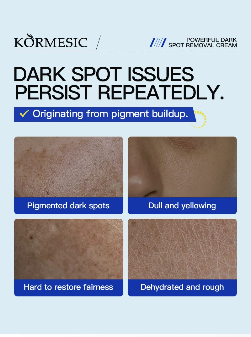 Powerful Dark Spot Removal Cream - Brighten & Fade Spots (20g) 3 dark spot removal face cream spu814926386434 desc 3