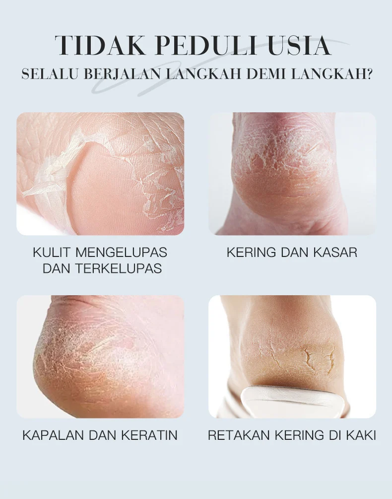 Foot Relief Cream for Dry Cracked Feet - Deep Moisturizing 60g 2 foot relief moisturizing cream spu947769884506 desc 2