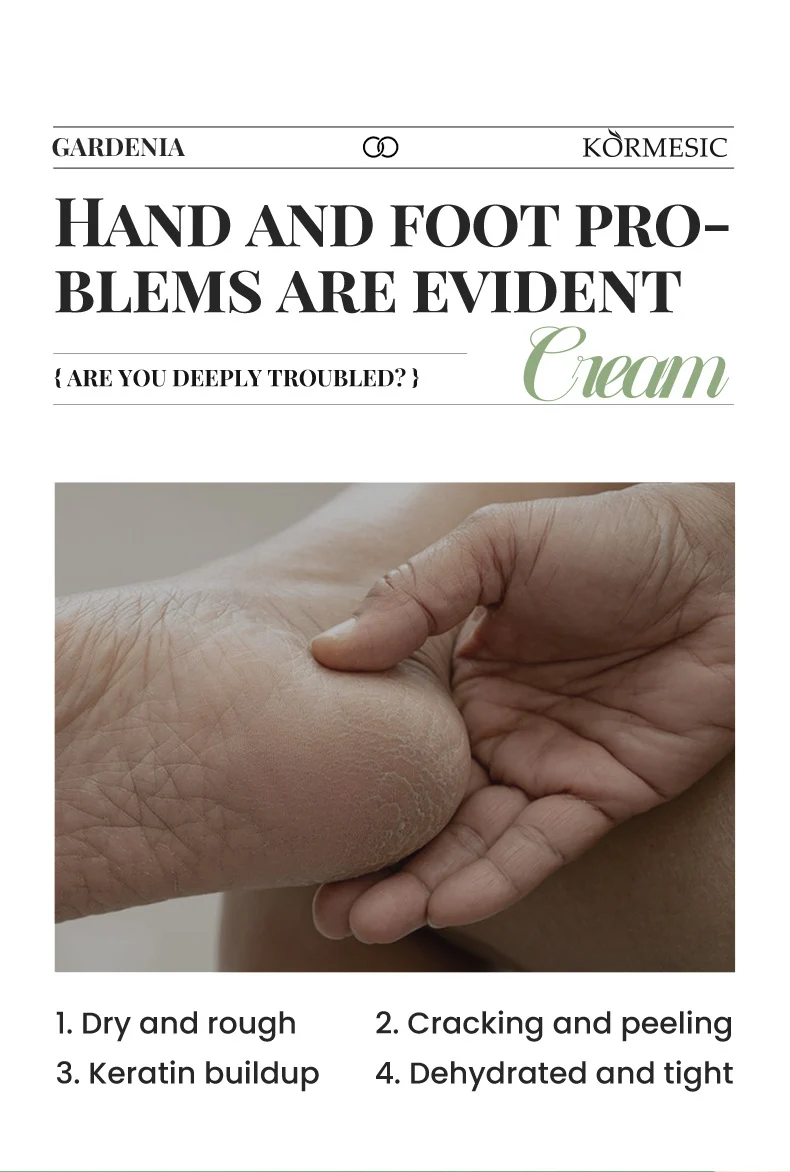 Gardenia Hand and Foot Cream Set - Nourishing & Repairing Duo for Dry Skin 2 gardenia hand foot cream set spu990371495212 desc 2