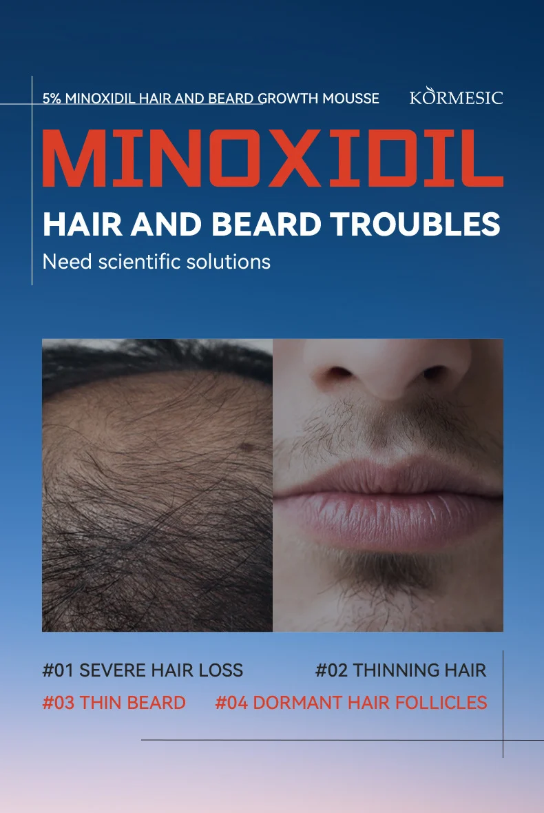 5% Minoxidil Hair & Beard Growth Mousse - 60ml for Thicker Hair 2 minoxidil hair beard growth mousse spu988344305130 desc 2
