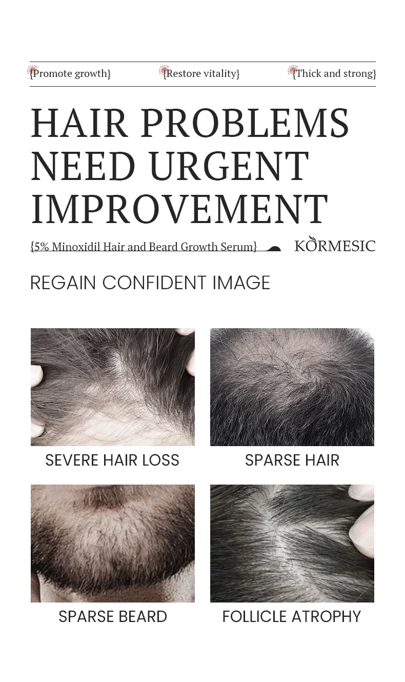 5% Minoxidil Hair Growth Serum for Hair and Beard (30ml) 2 minoxidil hair growth serum spu986518695233 desc 2