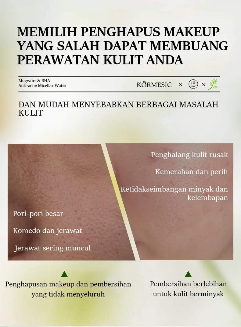 Mugwort & BHA Anti-Acne Micellar Water - 2-in-1 Cleanser for Oily Skin 2 mugwort bha micellar water spu957512974817 desc 2