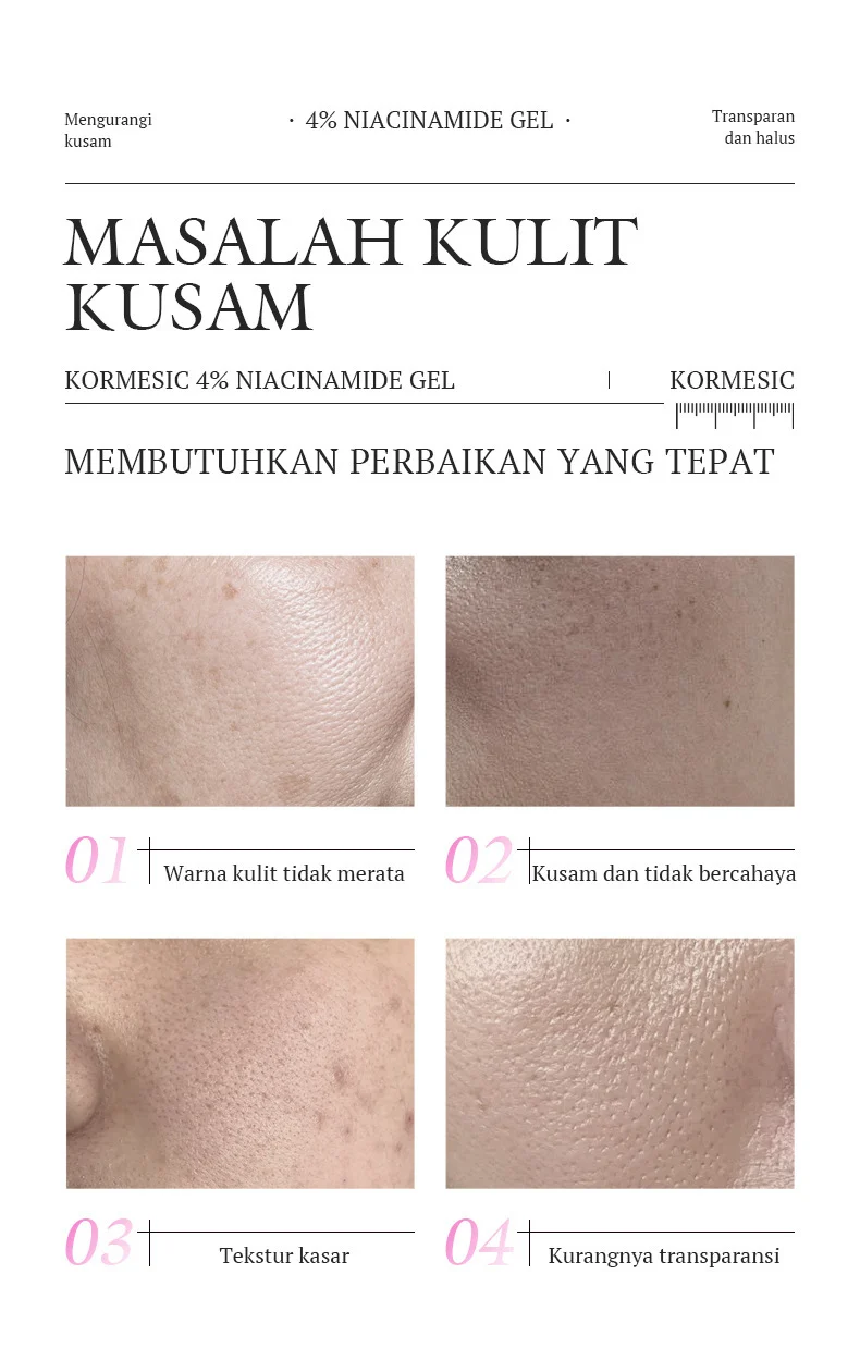 4% Niacinamide Brightening Gel - Improves Dullness & Smoothes Skin 4 niacinamide brightening gel spu979272306148 desc 4