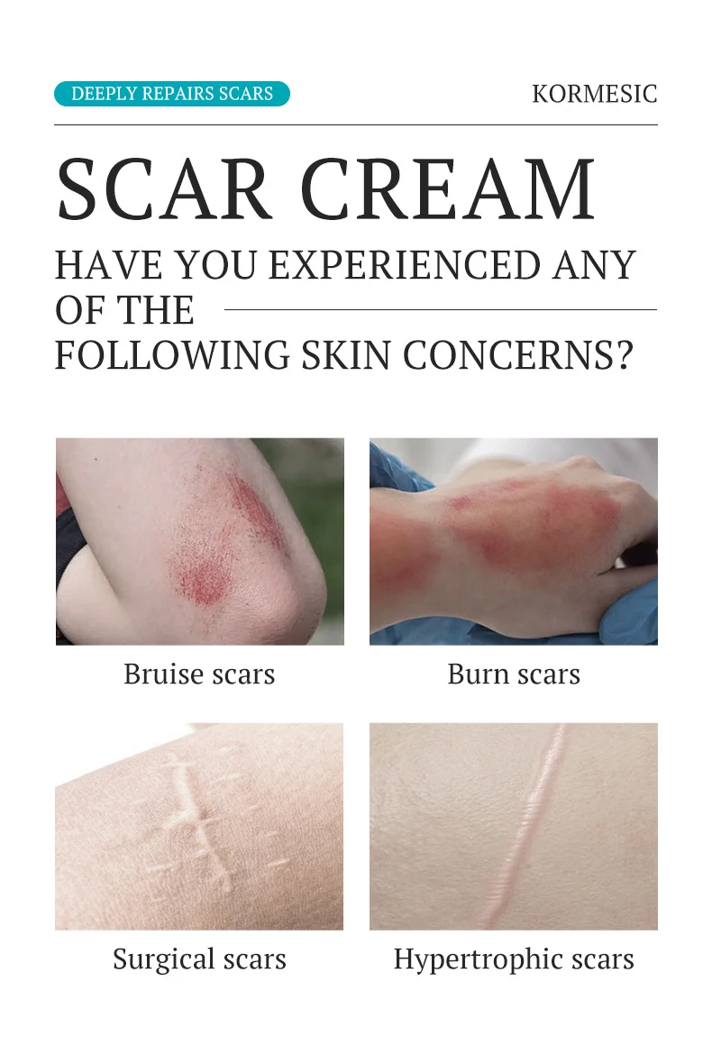 Scar Removal Cream - Deep Repair & Pigmentation Reduction (50g) 2 scar removal repair cream spu930920541941 desc 2