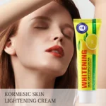 KORMESIC Skin Lightening Cream | Whitening Body Cream for Dark Spots & Hydration