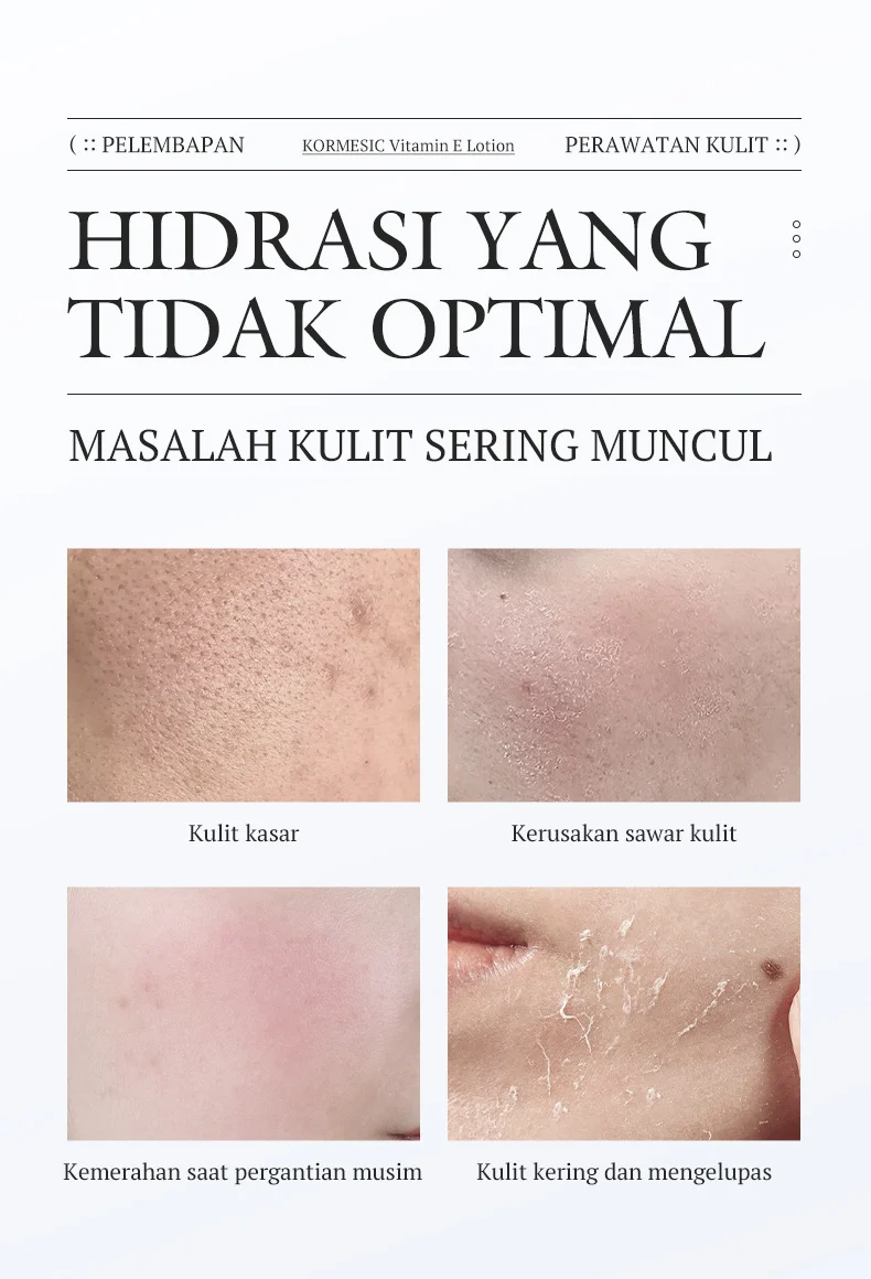 Vitamin E Lotion 100g - Brightening & Moisturizing Body Cream 2 vitamin e body lotion spu944119667724 desc 2